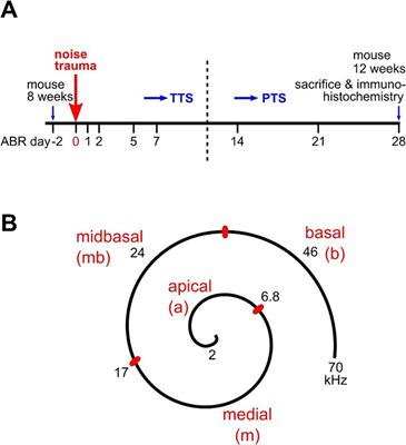 Noise-induced cochlear synaptopathy in C57BL/6 N mice as a function of trauma strength: ribbons are more vulnerable than postsynapses